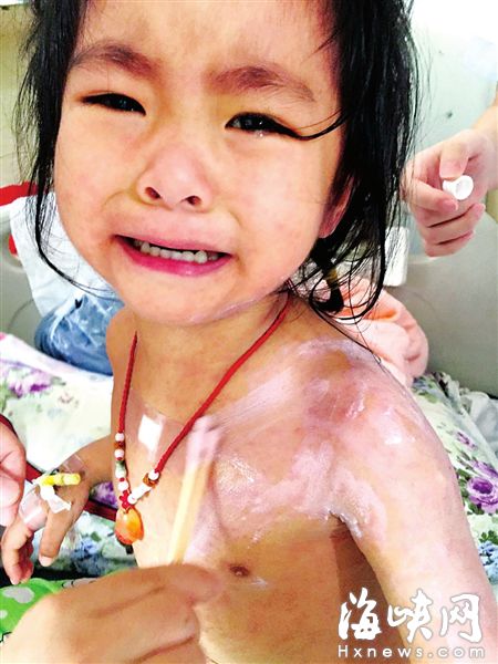 3岁的兰兰，全身红疹，因疼痒难忍而大哭