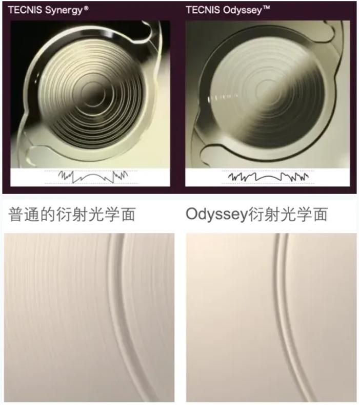 厦门眼科中心成功开展强生TECNISOdyssey奥德赛全视程人工晶状体植入术(图3)
